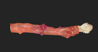 2004-4-artery